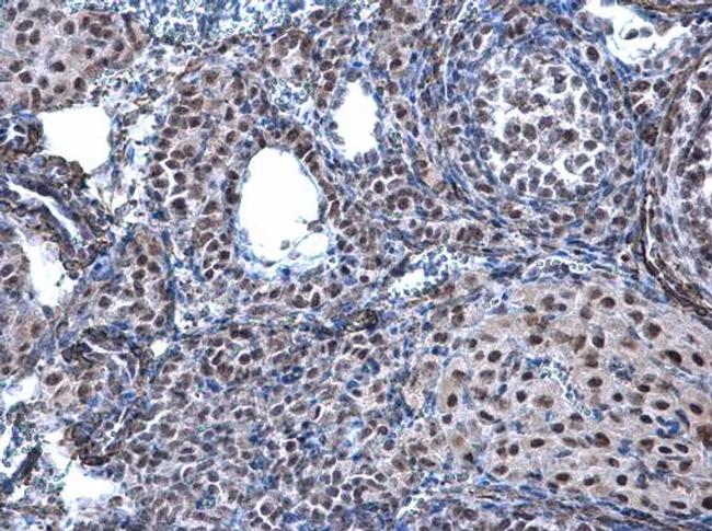 HP1 beta Antibody in Immunohistochemistry (Paraffin) (IHC (P))