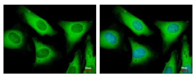 eIF2 beta Antibody in Immunocytochemistry (ICC/IF)