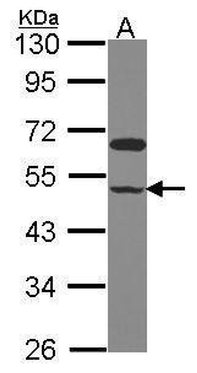 GRINL1A Antibody in Western Blot (WB)