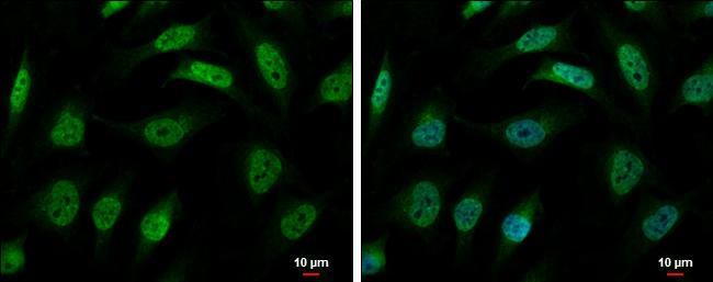 hnRNP R Antibody in Immunocytochemistry (ICC/IF)