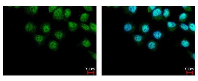 LIMD1 Antibody in Immunocytochemistry (ICC/IF)