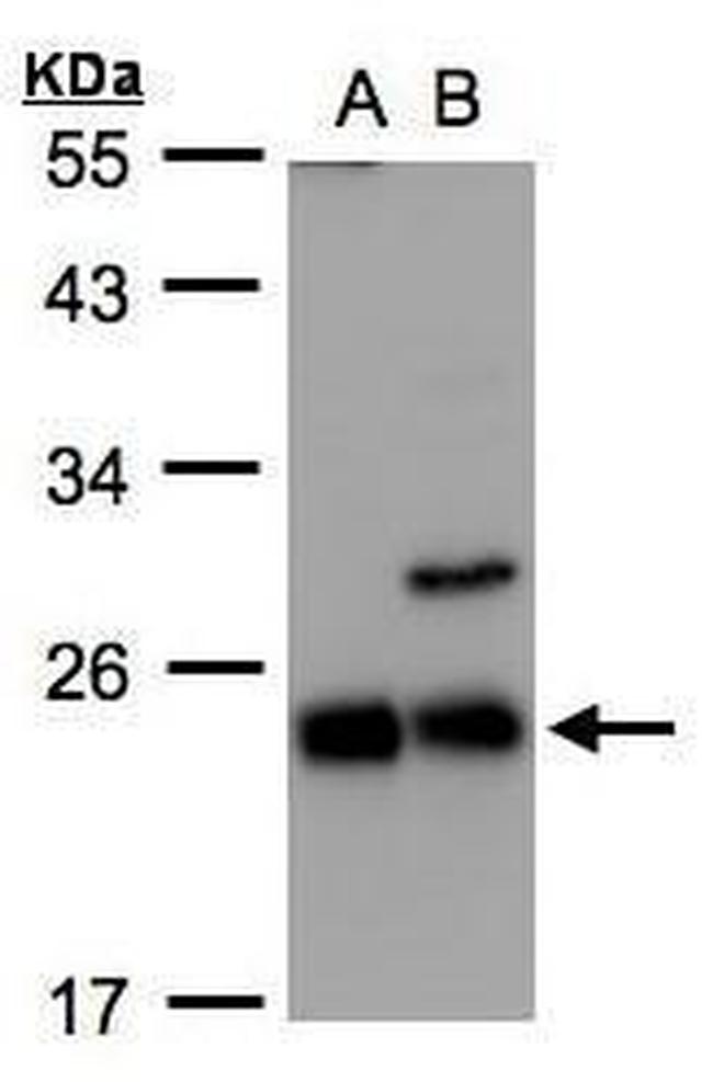 CBF beta Antibody in Western Blot (WB)