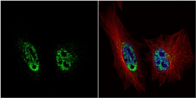 PRP19 Antibody in Immunocytochemistry (ICC/IF)