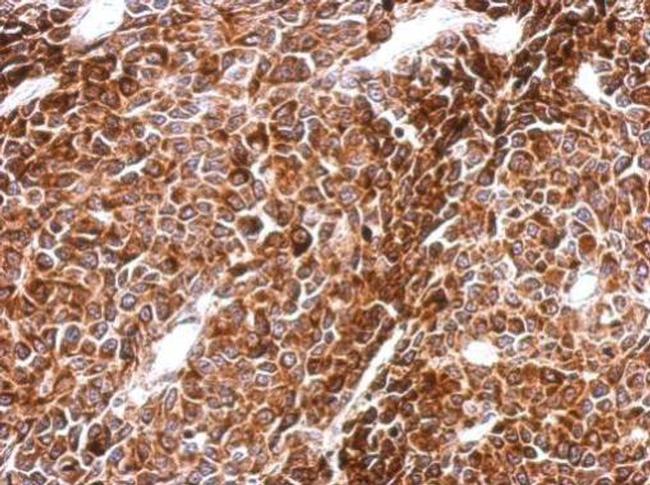 PHF16 Antibody in Immunohistochemistry (Paraffin) (IHC (P))