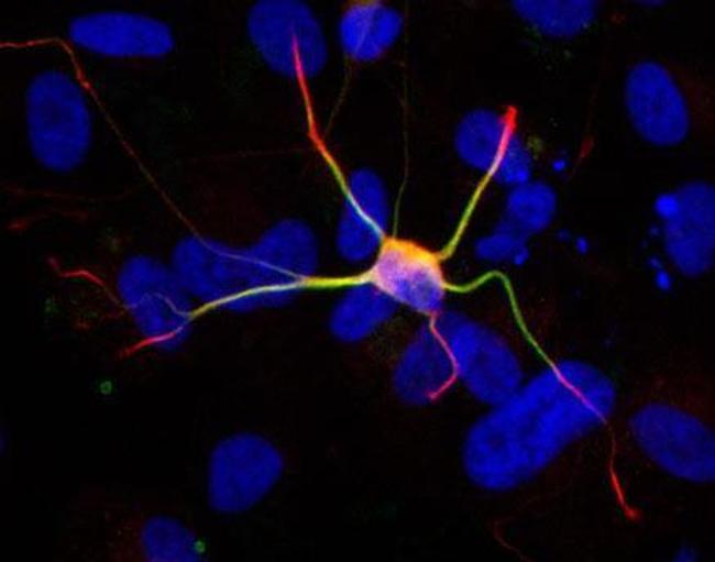 Doublecortin Antibody in Immunocytochemistry (ICC/IF)