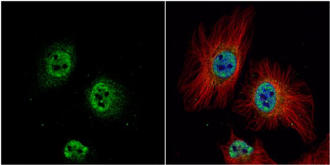 ZWINT Antibody in Immunocytochemistry (ICC/IF)