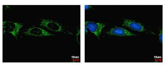 ALDH1B1 Antibody in Immunocytochemistry (ICC/IF)