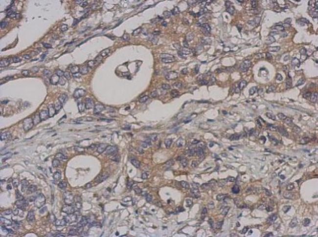 NCAPH Antibody in Immunohistochemistry (Paraffin) (IHC (P))