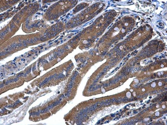 MEK6 Antibody in Immunohistochemistry (Paraffin) (IHC (P))