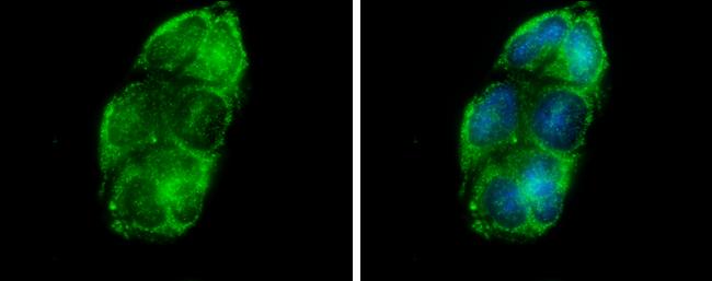 Glycerol kinase Antibody in Immunocytochemistry (ICC/IF)