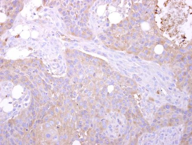 MST3 Antibody in Immunohistochemistry (Paraffin) (IHC (P))