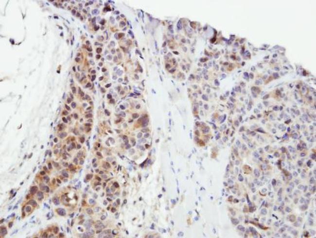 SPHK1 Antibody in Immunohistochemistry (Paraffin) (IHC (P))