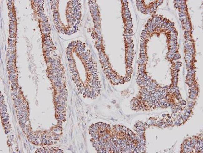 GK2 Antibody in Immunohistochemistry (Paraffin) (IHC (P))