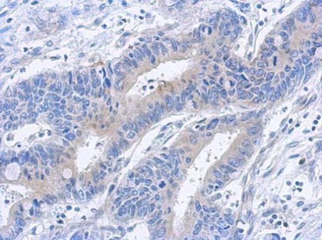 TAB1 Antibody in Immunohistochemistry (Paraffin) (IHC (P))