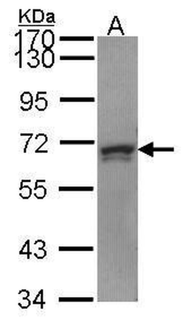 PRPF31 Antibody in Western Blot (WB)