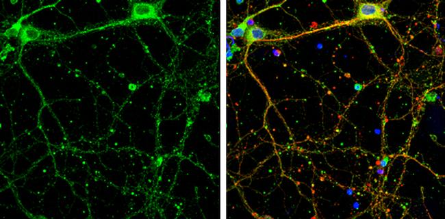 SHANK1 Antibody in Immunocytochemistry (ICC/IF)