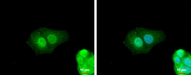 ZNF703 Antibody in Immunocytochemistry (ICC/IF)