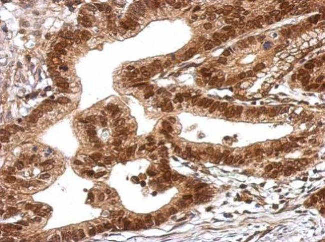 TRIM27 Antibody in Immunohistochemistry (Paraffin) (IHC (P))