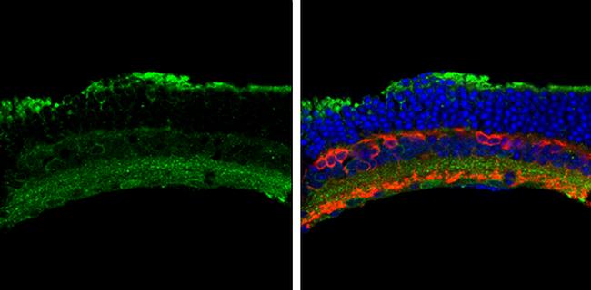 ACVR1 Antibody in Immunohistochemistry (Frozen) (IHC (F))