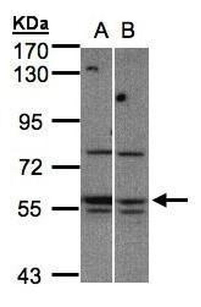 MST3 Antibody in Western Blot (WB)