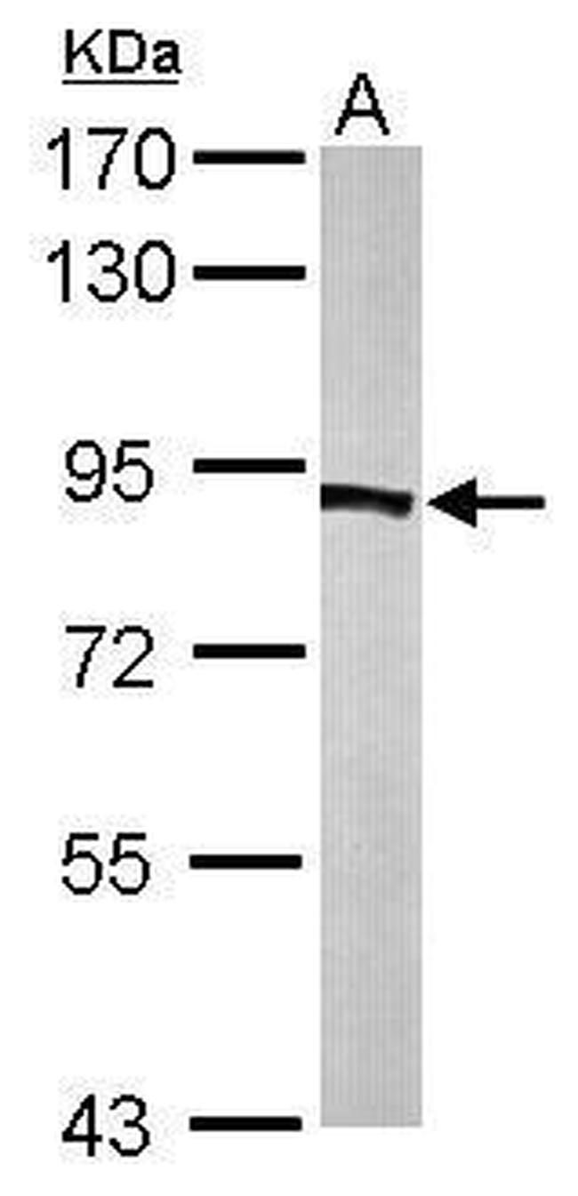 PFKP Antibody in Western Blot (WB)