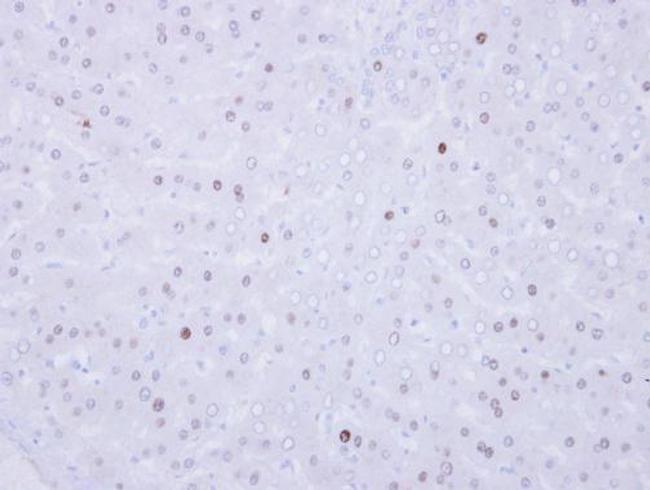 VRK1 Antibody in Immunohistochemistry (Paraffin) (IHC (P))