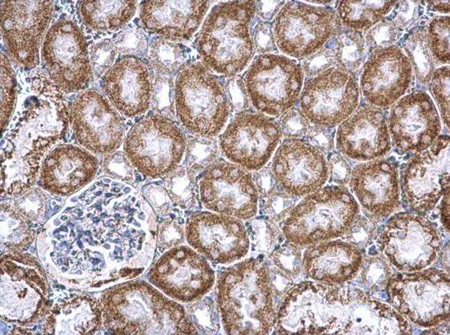 PUM2 Antibody in Immunohistochemistry (Paraffin) (IHC (P))