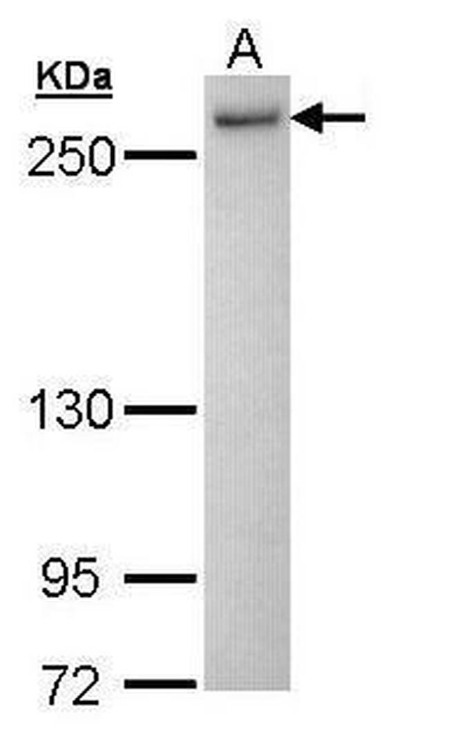 PRP8 Antibody in Western Blot (WB)