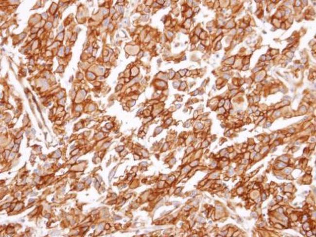 CYSLTR1 Antibody in Immunohistochemistry (Paraffin) (IHC (P))