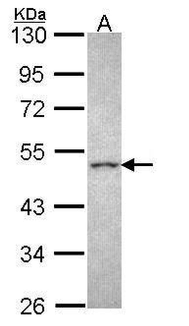 CRHR2 Antibody in Western Blot (WB)