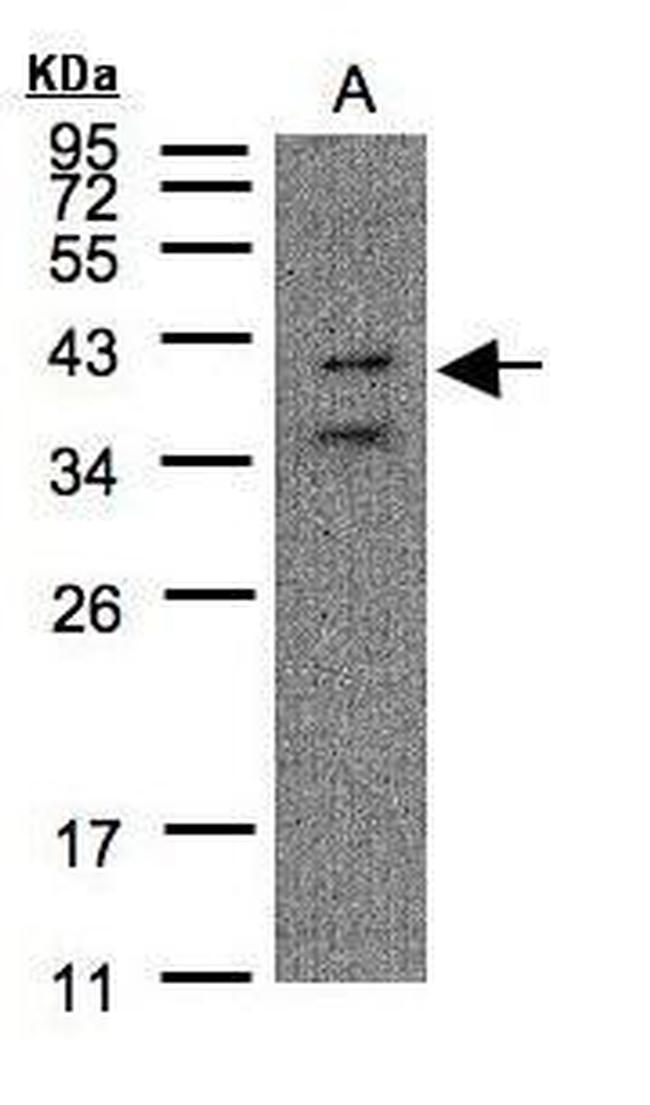 P2Y11 Antibody in Western Blot (WB)