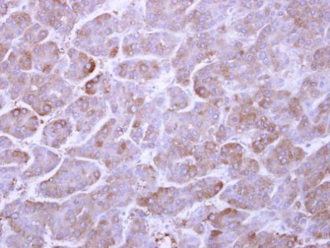 ARL1 Antibody in Immunohistochemistry (Paraffin) (IHC (P))