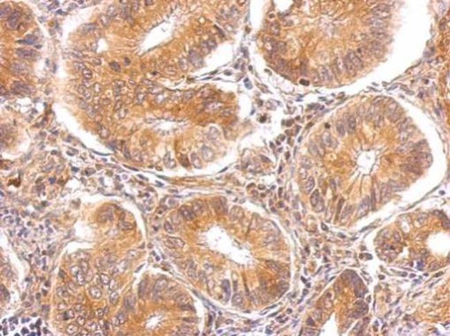 alpha TTP Antibody in Immunohistochemistry (Paraffin) (IHC (P))