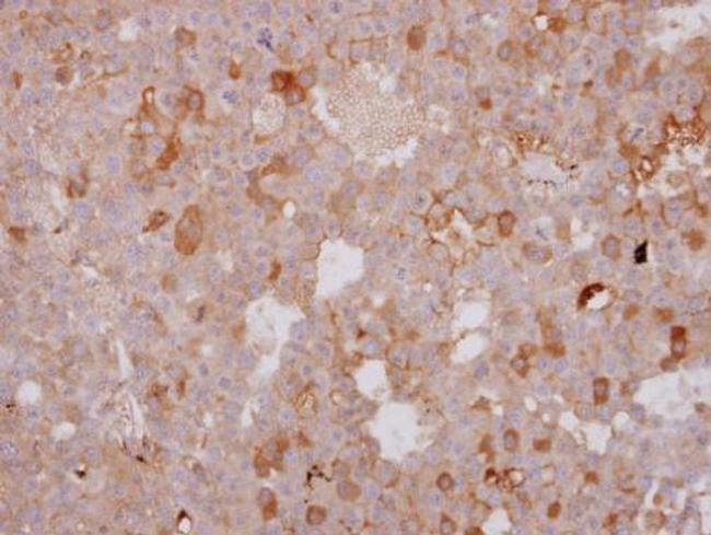 beta-1 Adrenergic Receptor Antibody in Immunohistochemistry (Paraffin) (IHC (P))