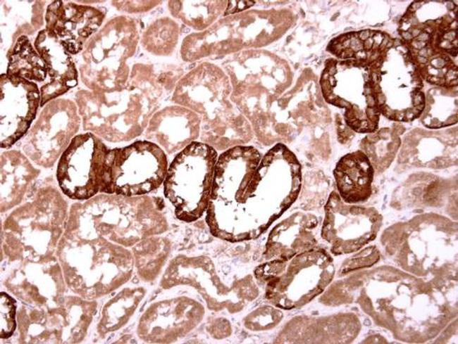 INHBB Antibody in Immunohistochemistry (Paraffin) (IHC (P))