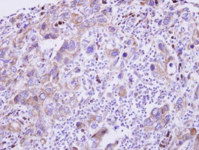 GDF5 Antibody in Immunohistochemistry (Paraffin) (IHC (P))