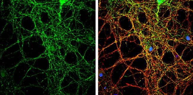 PACSIN1 Antibody in Immunocytochemistry (ICC/IF)