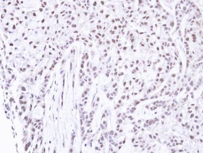 PNK Antibody in Immunohistochemistry (Paraffin) (IHC (P))