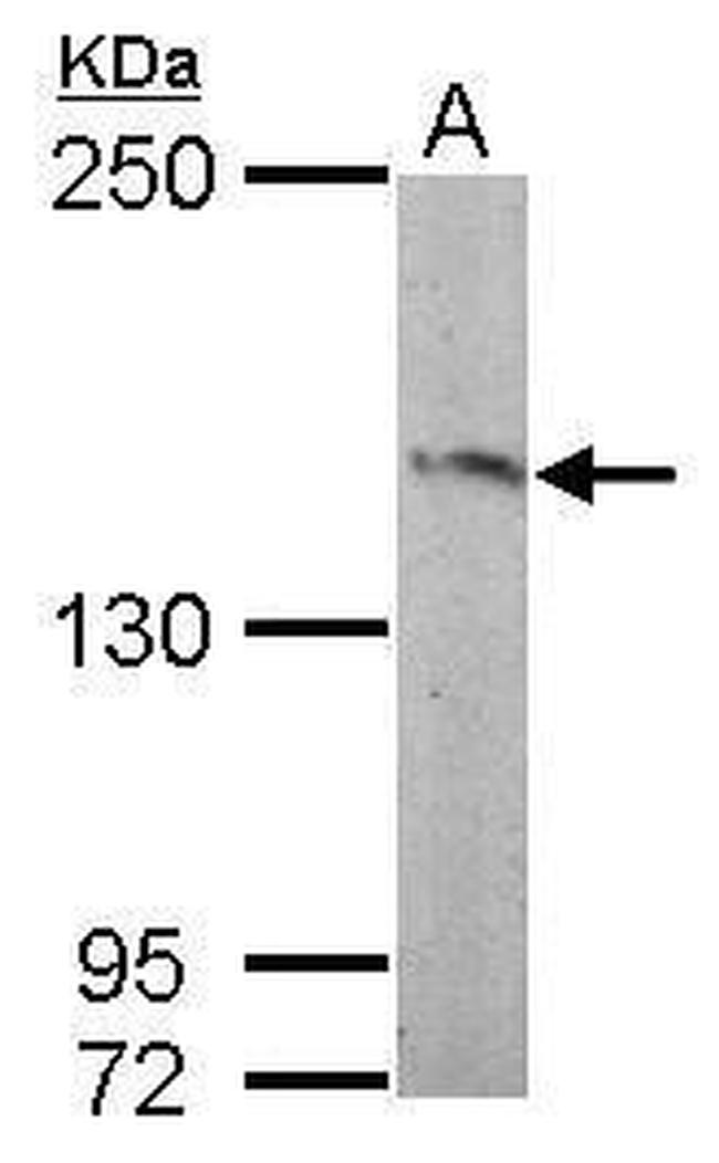 RASGRF2 Antibody in Western Blot (WB)