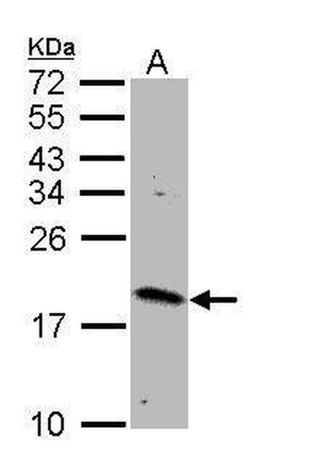 RHEB Antibody in Western Blot (WB)