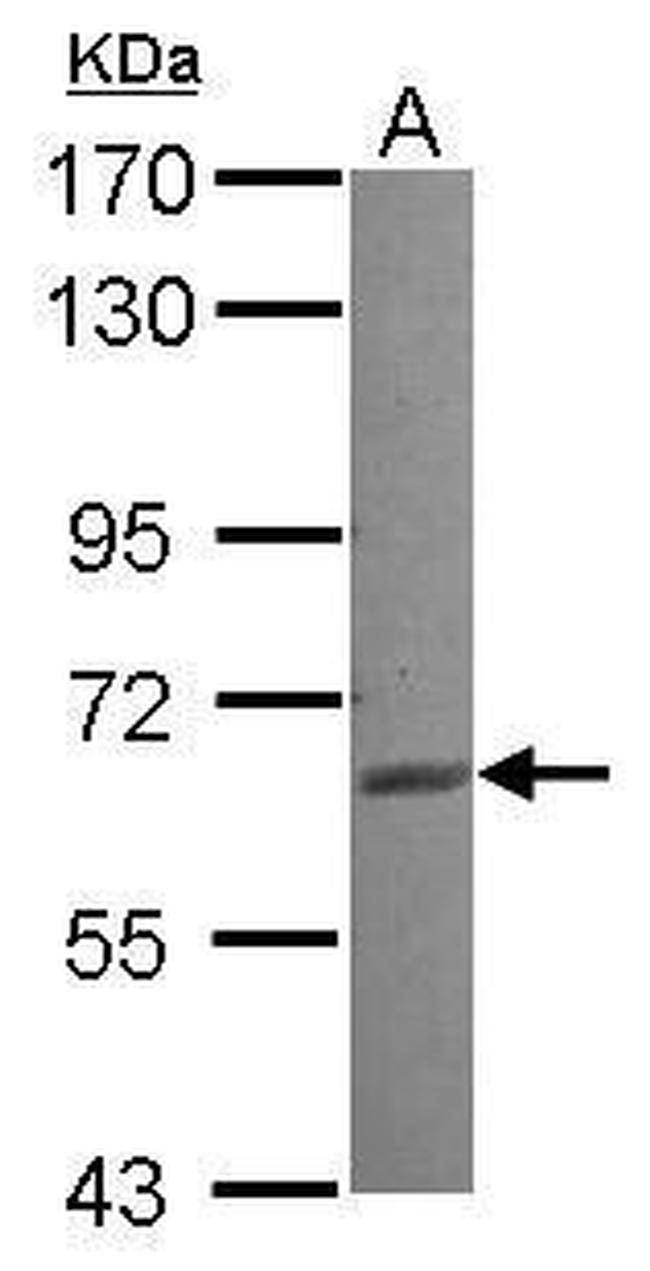 RASGRP2 Antibody in Western Blot (WB)