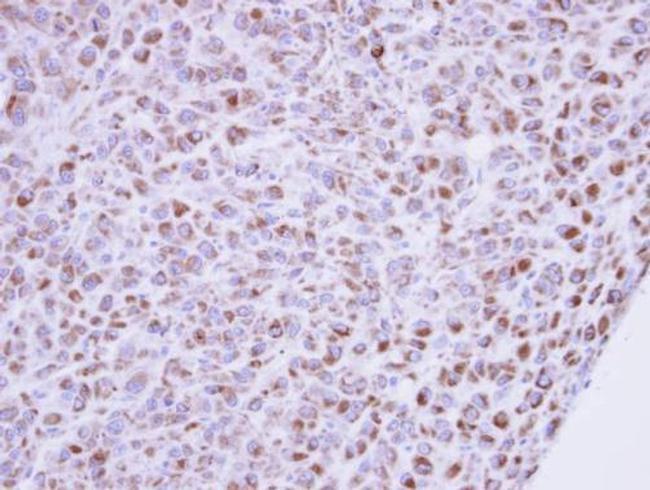 MINPP1 Antibody in Immunohistochemistry (Paraffin) (IHC (P))