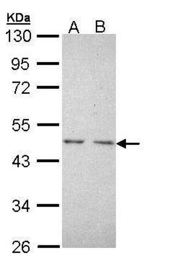 TR2 Antibody in Western Blot (WB)