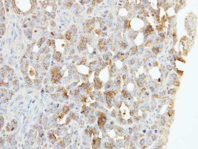 ZNF223 Antibody in Immunohistochemistry (Paraffin) (IHC (P))