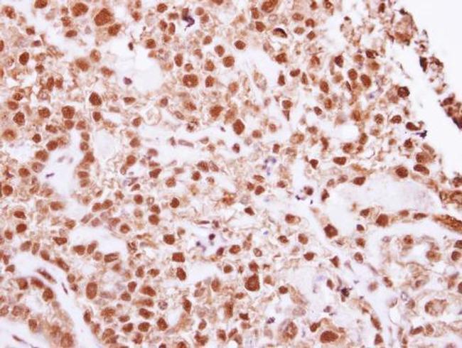 DNA ligase IV Antibody in Immunohistochemistry (Paraffin) (IHC (P))