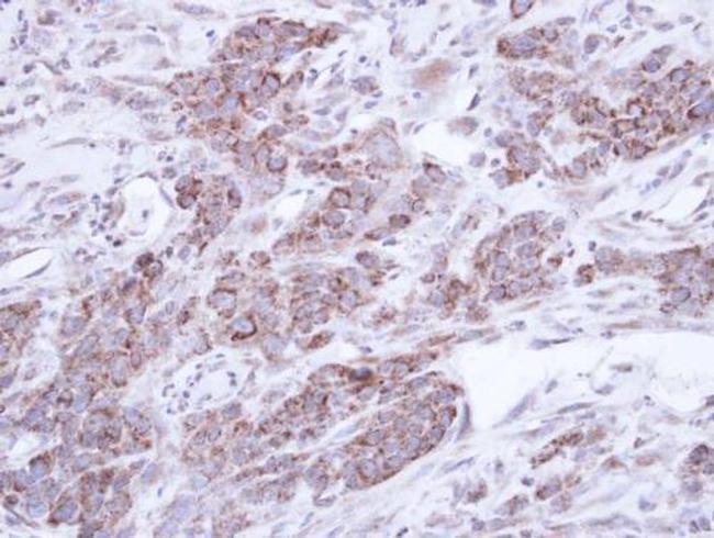 TNIP2 Antibody in Immunohistochemistry (Paraffin) (IHC (P))