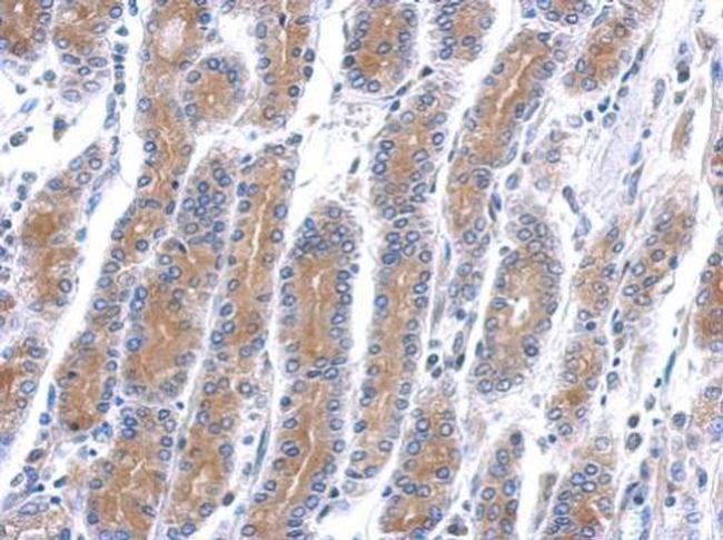 HSD17B6 Antibody in Immunohistochemistry (Paraffin) (IHC (P))