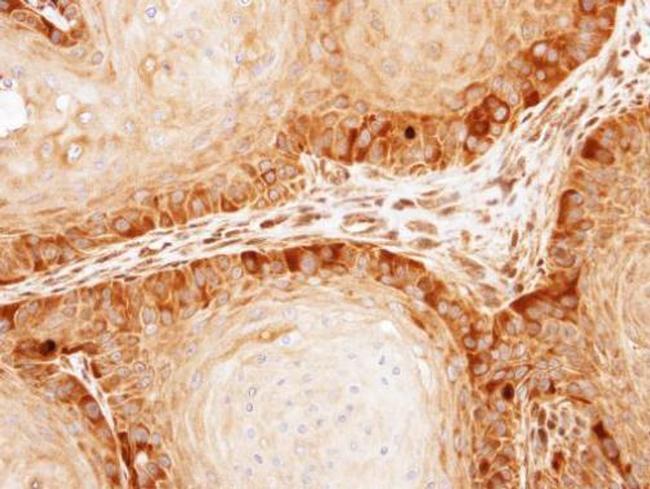 KIF11 Antibody in Immunohistochemistry (Paraffin) (IHC (P))