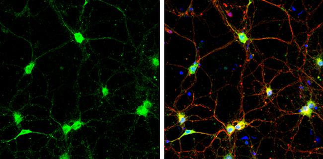 SNAP23 Antibody in Immunocytochemistry (ICC/IF)