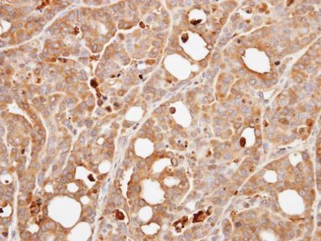 Calcineurin B Antibody in Immunohistochemistry (Paraffin) (IHC (P))